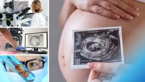 Cost of IVF in Bangalore