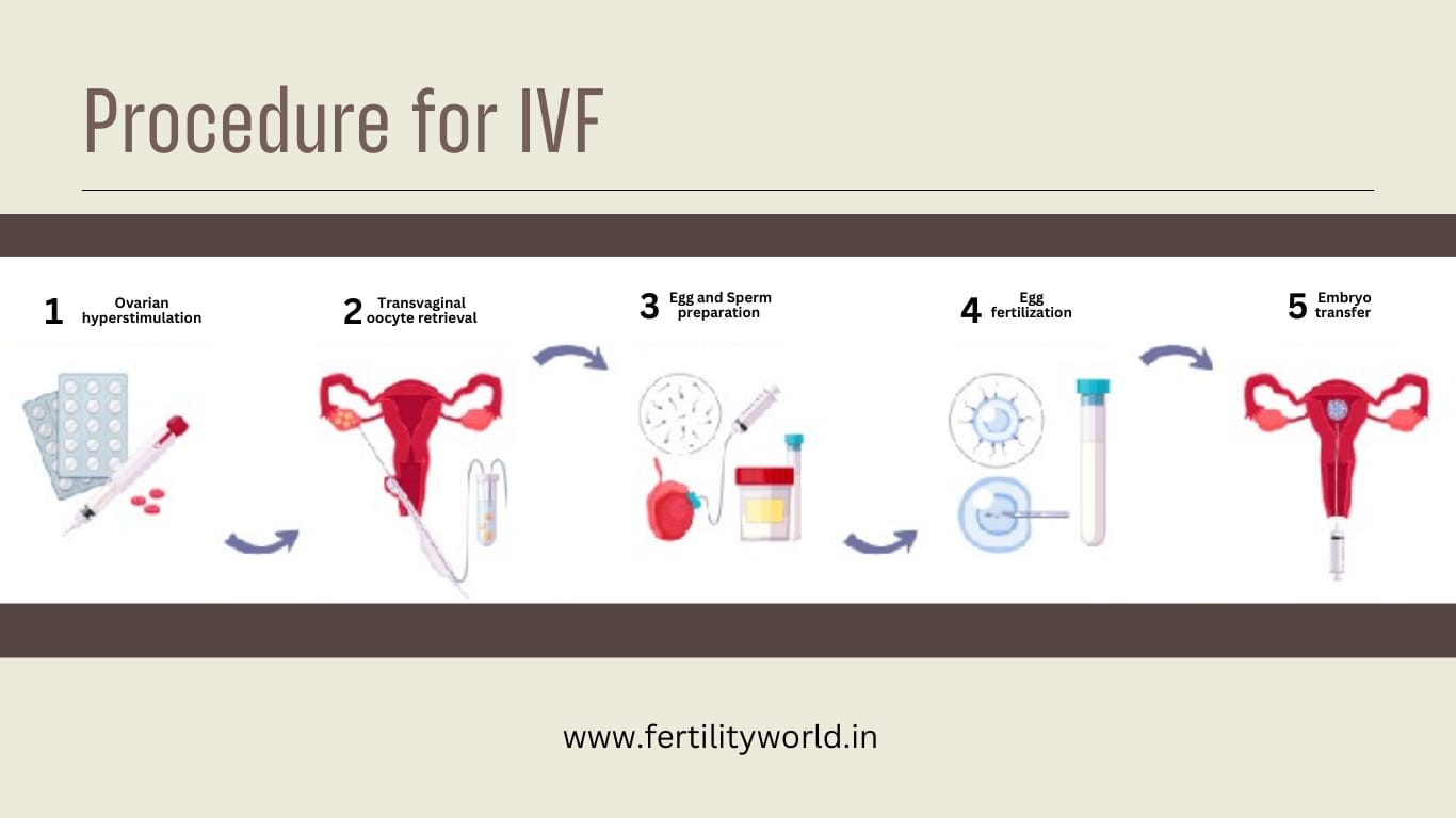 Procedure for IVF in Varanasi