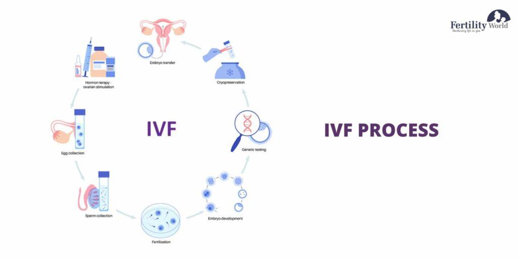 IVF Treatment Process in Hyderabad