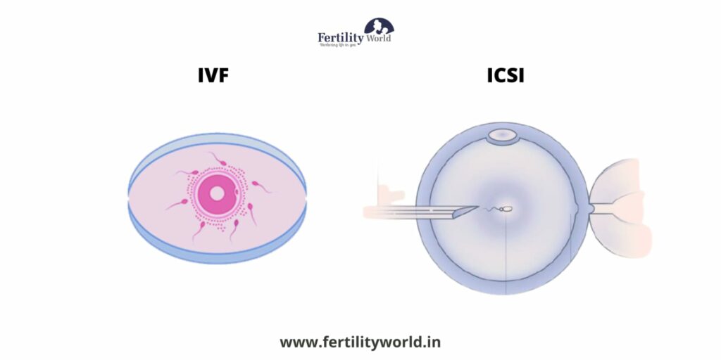 IVF and ICSI