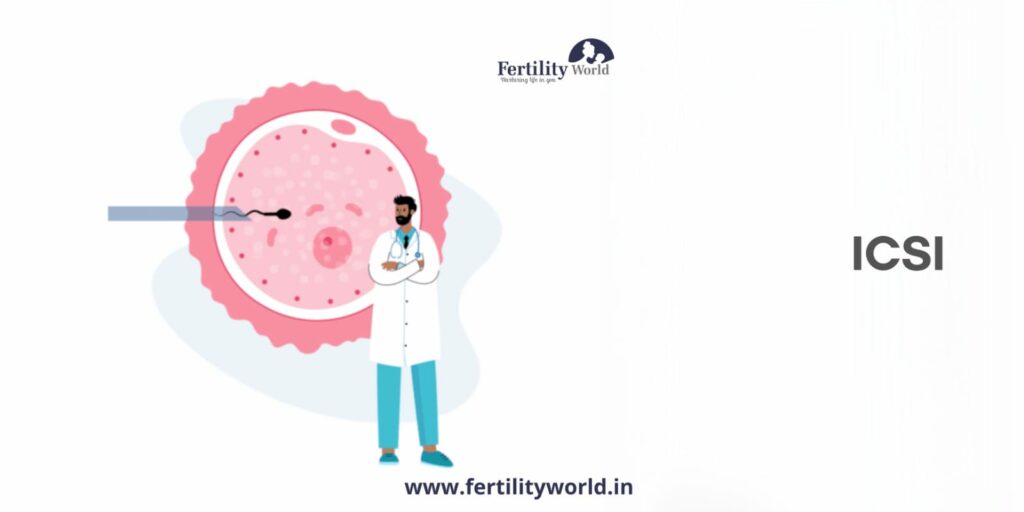 Intracytoplasmic Sperm Injection (ICSI)