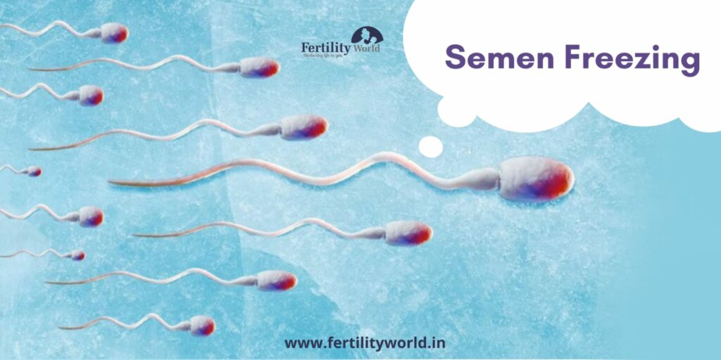 Sperm Freezing Program by Fertility World