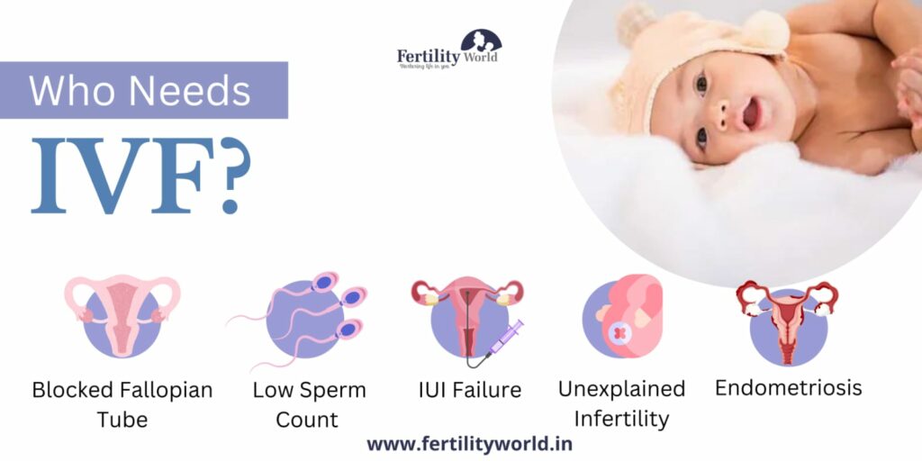 When should I consider IVF?