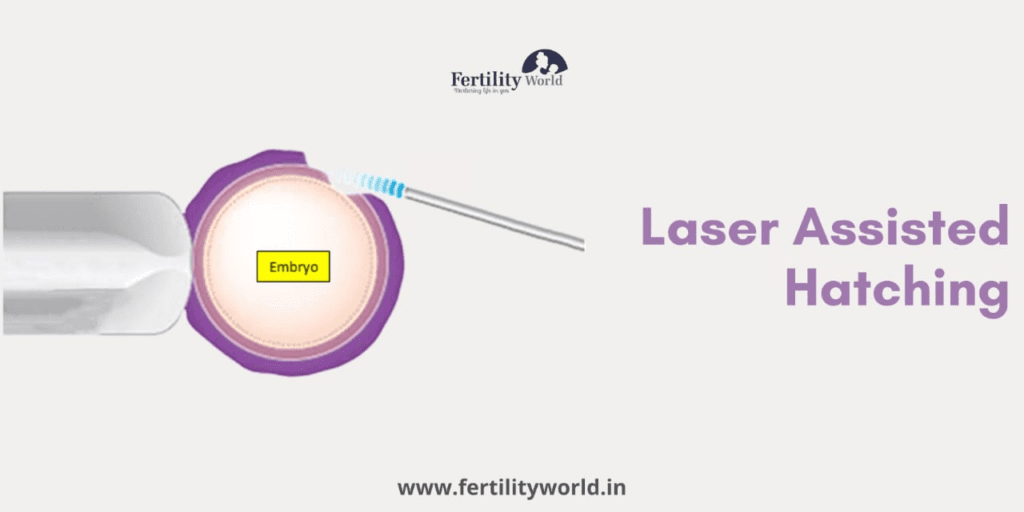 Cost of Laser-assisted Hatching in Noida