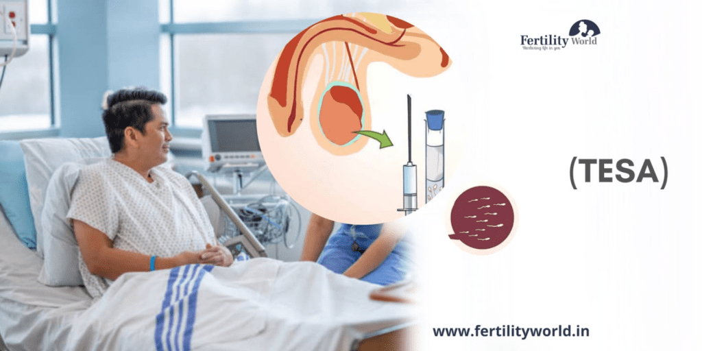 Cost of Testicular Sperm Aspiration (TESA)