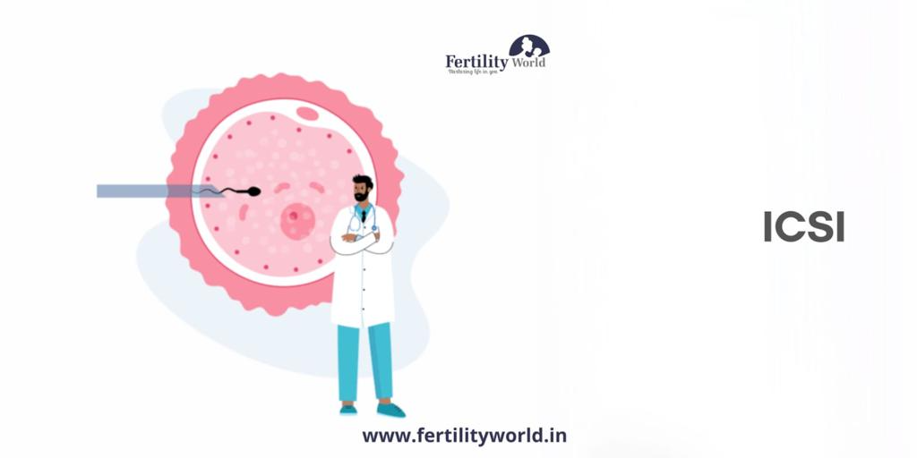 Intracytoplasmic sperm injection (ICSI)