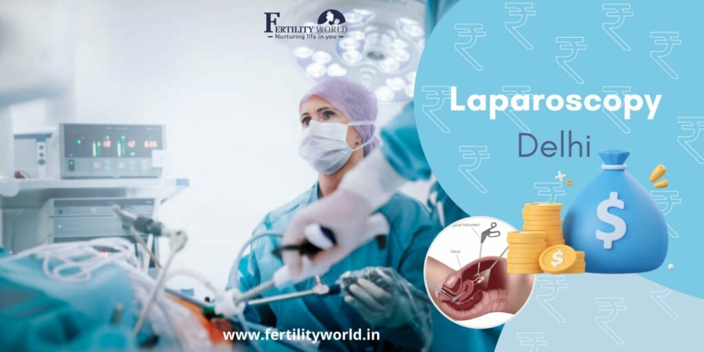 Laparoscopic surgery cost in Delhi